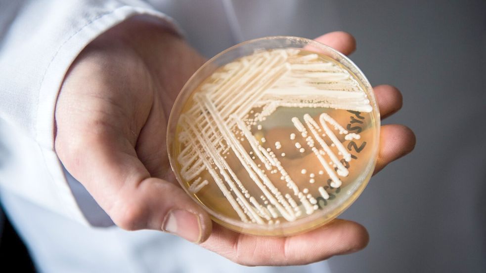 Eine Petrischale mit dem Hefepilz Candida auris. In Deutschland werden immer mehr Fälle des krankmachenden Pilzes bekannt. Foto: Nicolas Armer/dpa