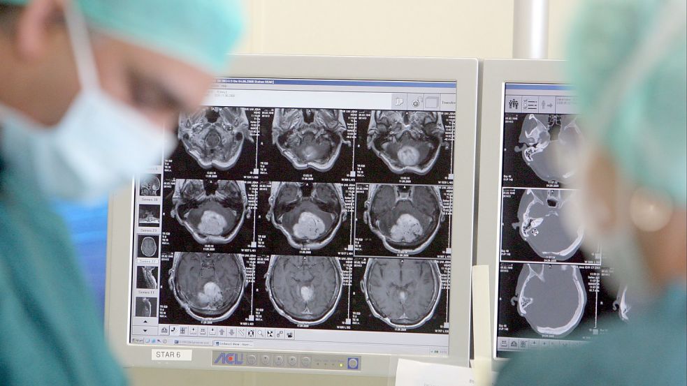 Es gibt verschiedene Arten von Hirntumoren – ein Arztbesuch ist unumgänglich. Foto: dpa/Jan-Peter Kasper