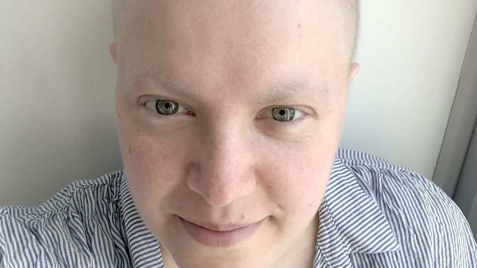 Anna Güttler während ihrer Chemotherapie im Sommer 2021.
