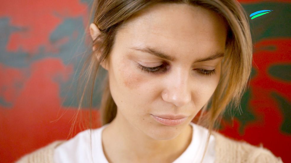 Im Emder Frauenhaus finden Opfer von häuslicher Gewalt Zuflucht. Symbolbild: pexels.com