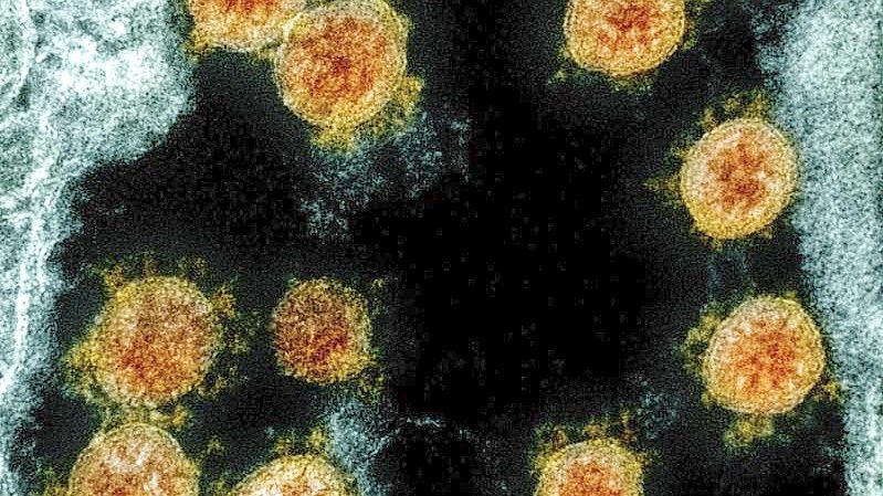 Eine elektronenmikroskopische Aufnahme zeigt Partikel des Coronavirus SARS-CoV-2. Foto: Uncredited/NIAID/NIH/dpa