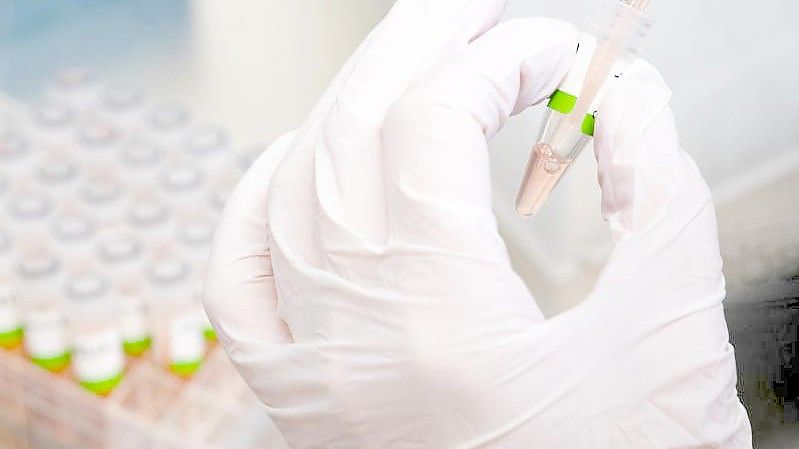 Im Labor wird ein PCR-Test auf das Coronavirus vorbereitet. Foto: Julian Stratenschulte/dpa