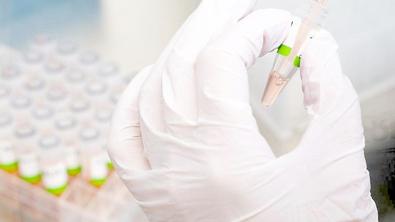 Es wird vermutet, dass viele Menschen ihre Infektion nicht mehr über einen PCR-Test bestätigen lassen. Foto: Julian Stratenschulte/dpa