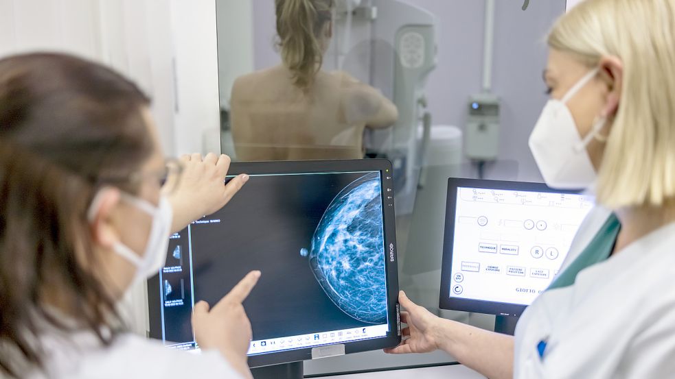 Medizinisches Personal untersucht mit einer Mammografie die Brust einer Frau auf Brustkrebs. Foto: Hanschke/dpa