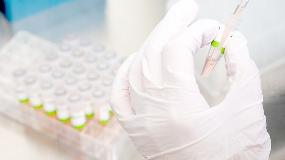 Eine biologisch-technische Assistentin bereitet im Niedersächsischen Landesgesundheitsamt PCR-Tests für die Analyse vor. Foto: Julian Stratenschulte/dpa