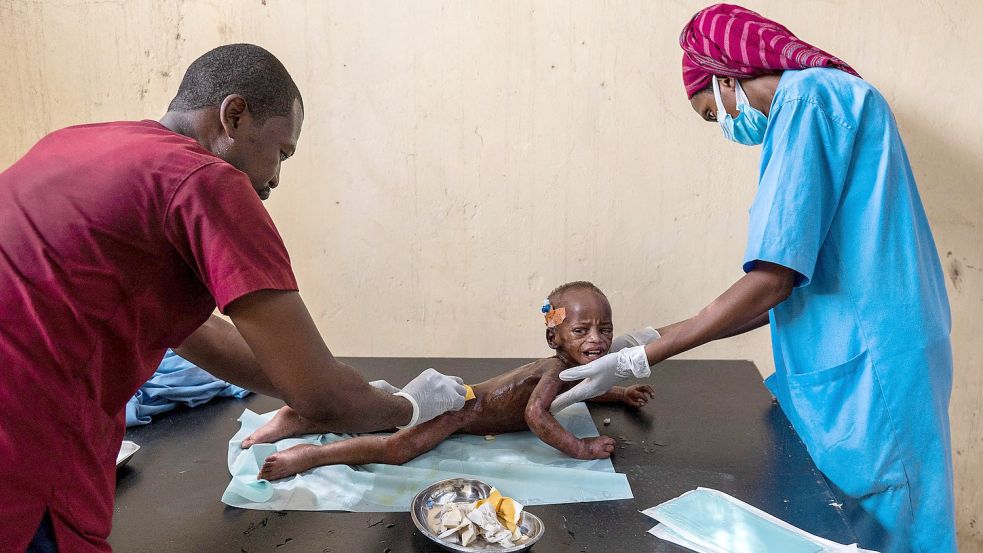 Ärzte kümmern sich um ein unterernährtes Kind im Tschad. Foto: ANDREW CABALLERO-REYNOLDS / AFP