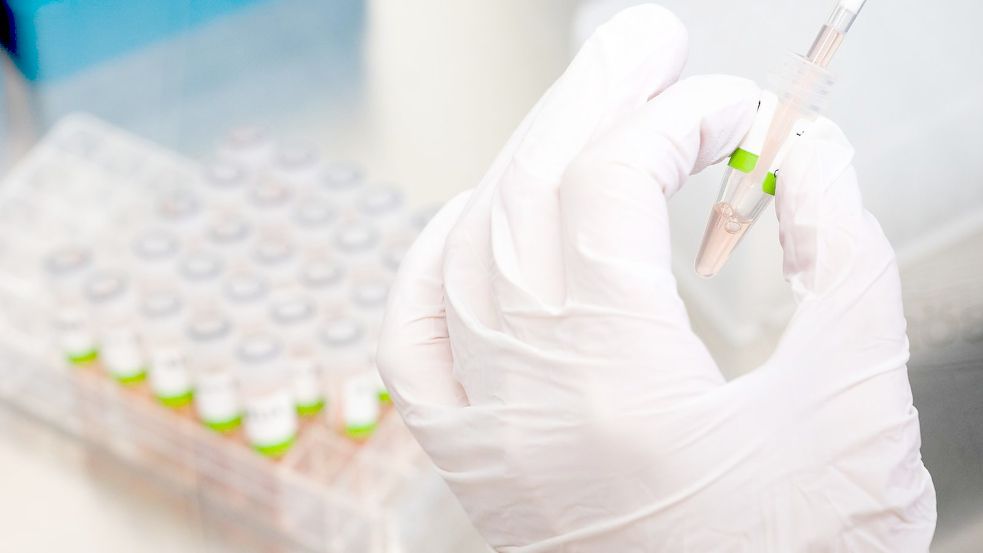 ARCHIV - Eine biologisch-technische Assistentin bereitet PCR-Tests für die Analyse vor. Foto: Julian Stratenschulte/dpa/Symbolbild Foto: Julian Stratenschulte