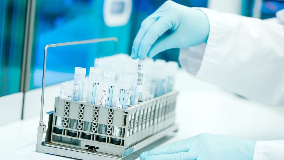 Ein Mitarbeiter hält in einem Coronatest-Labor PCR-Teströhrchen in den Händen. Foto: Uwe Anspach/dpa