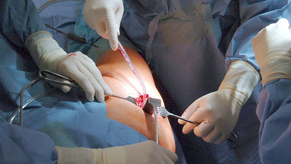 Eine Hüft-Operation wird von vielen Patienten so lange wie möglich hinausgeschoben. Foto: dpa/Weissbrod