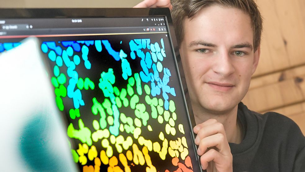 Was für andere aussieht wie ein Bildschirmschoner, ist für David Rutkevich die Darstellung von Blutzellen, die sein Algorithmus erkennen kann. Foto: Ortgies