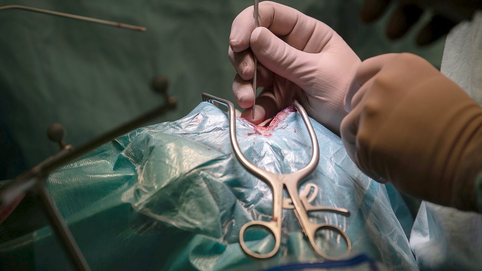 Während einer Gehirn-Operation ist am Evangelischen Krankenhaus Oldenburg eine Schädeldecke auf den Boden gefallen. Das Foto zeigt eine andere Operation in einer Neurochirurgie am offenen Schädel eines Patienten. Symbolfoto: Murat/dpa
