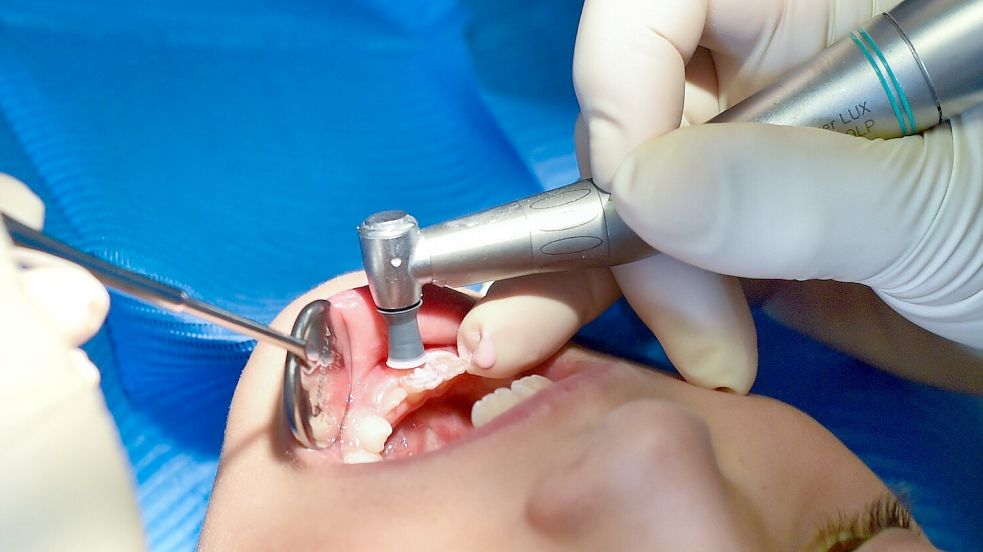 Welche Folgen hat die Vorgehensweise von AOK, BKK, IKK und anderen Primärkassen für die zahnmedizinische Behandlung ihrer Versicherten? Symbolfoto: Pleul/dpa