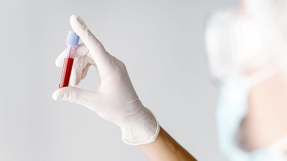 In der Eigenbluttherapie wird entnommenes Blut etwa mit Ozon und Sauerstoff versetzt und wieder injiziert. Ob‘s hilft? Foto: IMAGO/Oleksandr Latkun