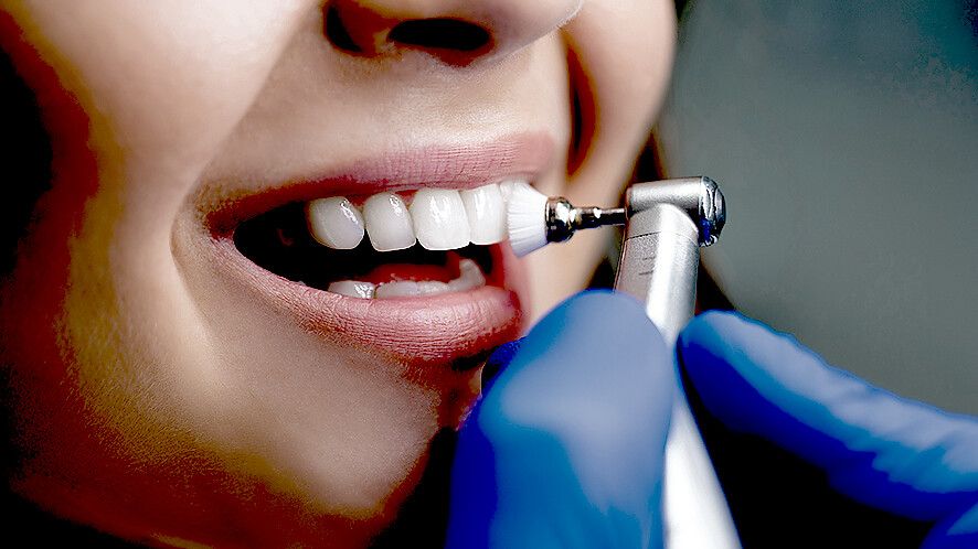 Prophylaxe: Auch die professionelle Zahnreinigung wird in Filsum angeboten. Foto: Adobe Stock/Studioprodakshn
