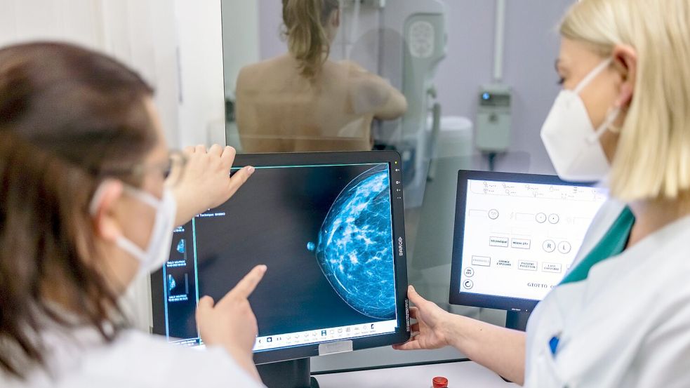 Medizinisches Personal untersucht mit einer Mammografie die Brust einer Frau auf Brustkrebs. Foto: Hannibal Hanschke/dpa