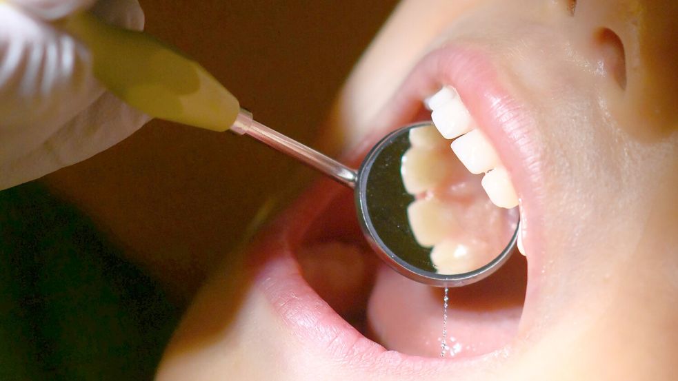 Weiß und ohne Löcher – so sehen gesunde Zähne aus. Foto: Julian Stratenschulte/dpa