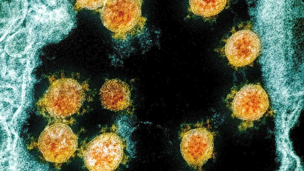Partikel des Coronavirus SARS-CoV-2 wurden für eine elektronenmikroskopische Aufnahme farblich bearbeitet. Foto: Uncredited/NIAID/NIH/dpa