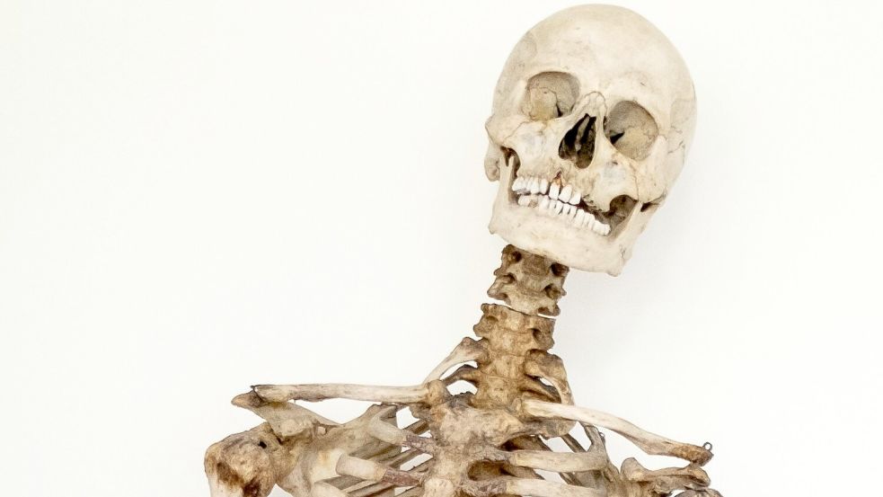 Dank wissenschaftlicher Analysen und eines Verwandten weiß man nun, dass dieses Skelett die sterblichen Überreste des Räubers Schinderhannes sind. Foto: Sara Doll/Medizinische Fakultät Heidelberg/dpa