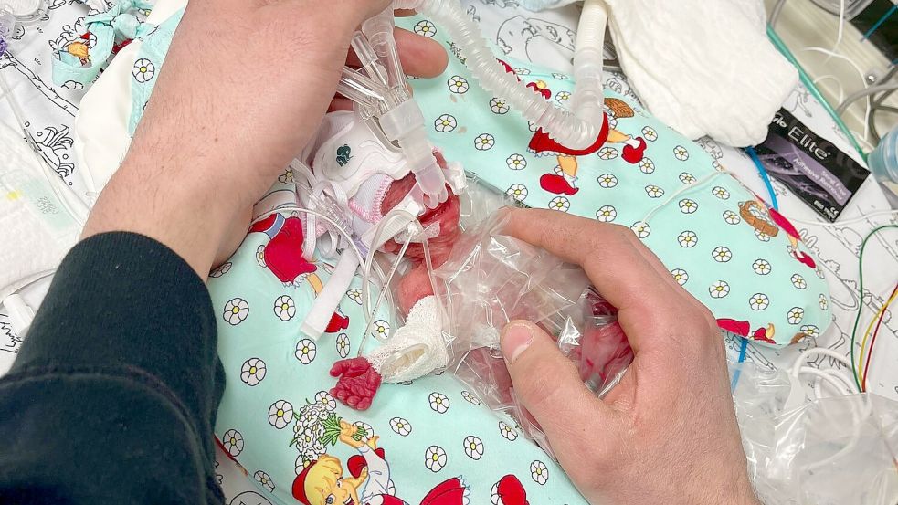 Etwas mehr als ein Päckchen Butter wog die kleine Marie, als sie im Februar zur Welt kam. Seitdem ist das Kind gut gewachsen. Foto: Privat/Kinderklinik Dritter Orden Passau/dpa