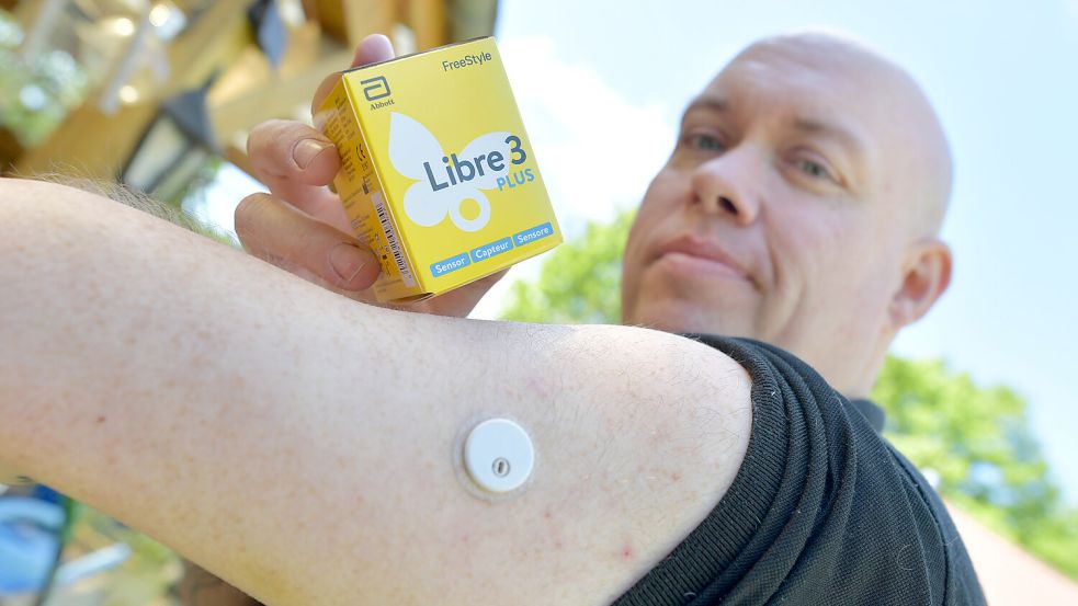 Marco Kampen hat einen Glukose-Sensor am Arm. Dieser übermittelt die Blutzuckerwerte live an das Handy. Foto: Klaus Ortgies