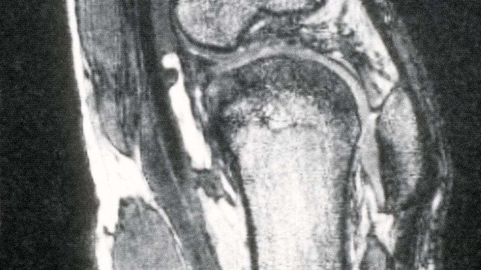 Schmerzen im Knie treiben viele Versicherte zum Orthopäden - viele kommen dort mit fragwürdigen Therapien in Kontakt. (Archivbild) Foto: picture alliance / dpa