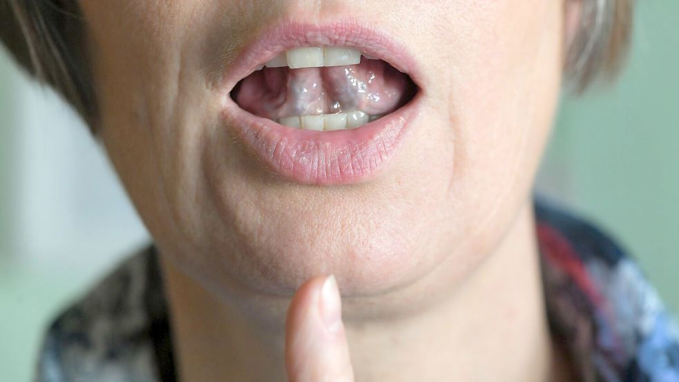 Stotternde Menschen können mit Hilfe von regelmäßigen Sprechübungen ihren Redefluss verbessern. (Symbolbild) Foto: Jens Kalaene