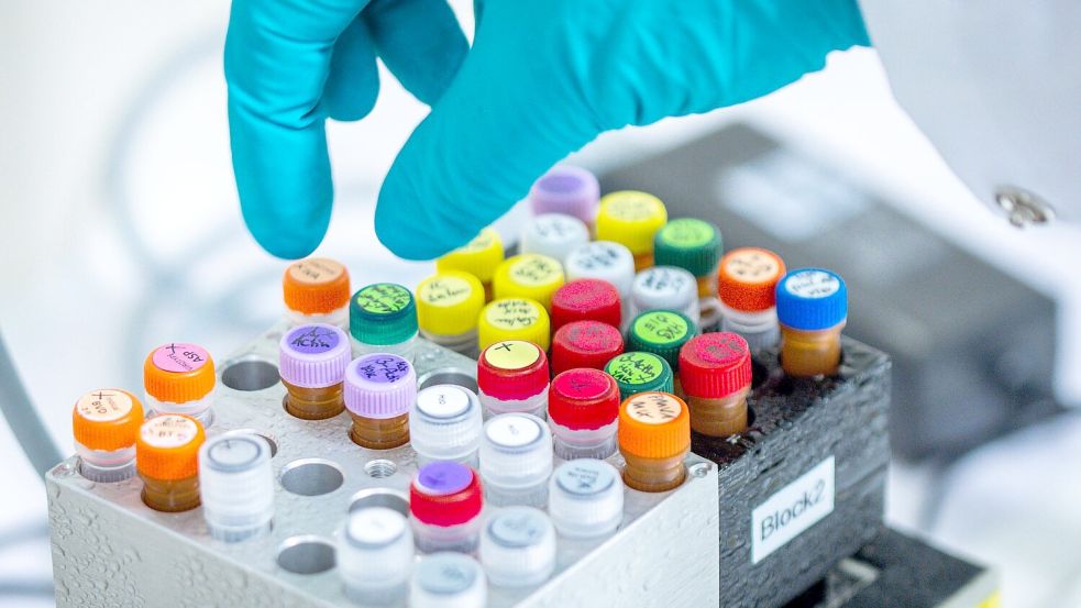 Ehec bezeichnet bestimmte krankmachende Stämme des Darm-Bakteriums, die vor allem bei Wiederkäuern wie Rindern vorkommen (Archivbild). Foto: Jens Büttner