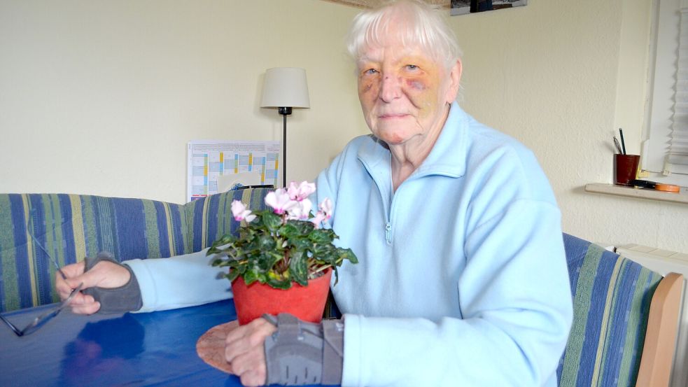 Auch eine gute Woche später noch sind Ilona Höschler die Blessuren, die sie bei ihrem Sturz auf offener Straße davongetragen hat, deutlich anzusehen. Die 80-Jährige trug neben Hämatomen und Platzwunden eine gebrochene Nase und eine geprellte Schulter davon. Foto: Astrid Fertig