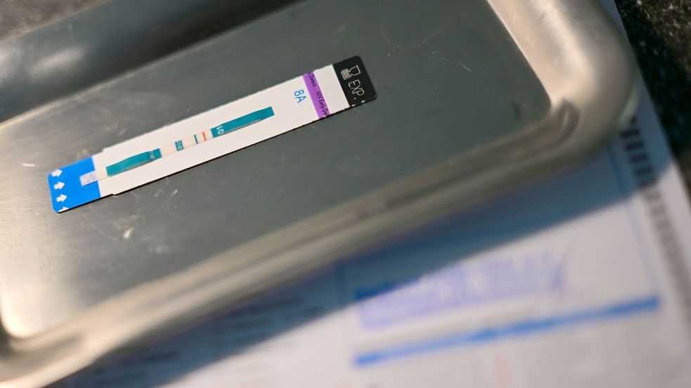 HIV-Diagnosen werden oft erst Jahre nach der Infektion gestellt. (Symbolbild) Foto: Sebastian Gollnow