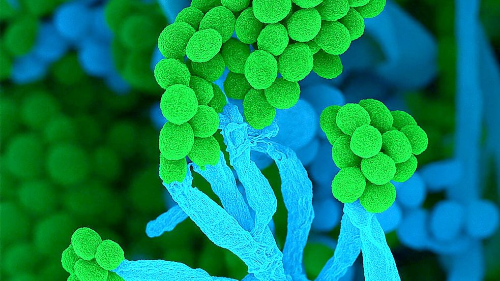 Penicillium bedeutet auf Lateinisch „kleiner Pinsel“, weil die Zellketten mit Sporen am Ende so ähnlich aussehen (Handout) Foto: Ulrich Kück/ Birgit Hoff/Vereini