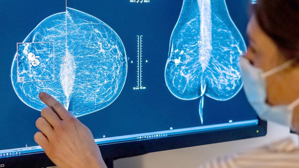 2023 wurden rund eine halbe Million Menschen in Deutschland mit Krebs diagnostiziert. (Symbolbild) Foto: Hannibal Hanschke