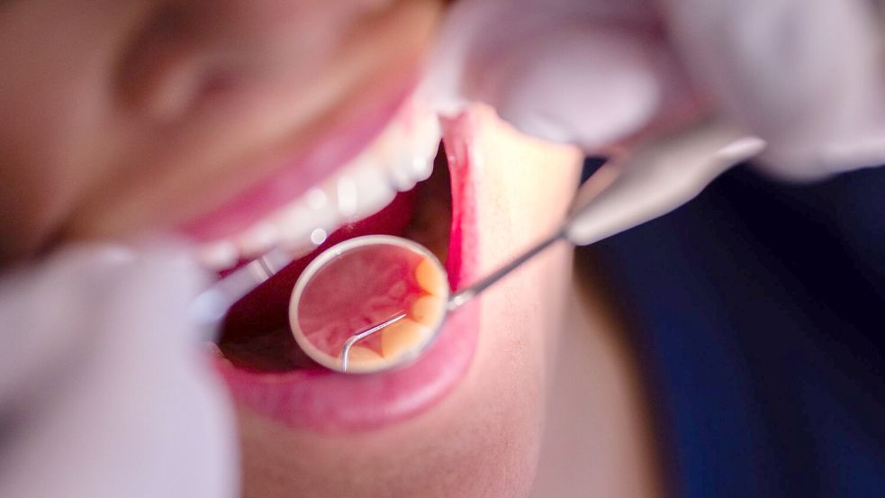 Zahnarztbehandlungen sollen nach dem Willen des CDU-Wirtschaftsrats „nicht länger im Umlageverfahren den Beitragszahlern zur Last fallen“. (Symbolbild) Foto: Rolf Vennenbernd