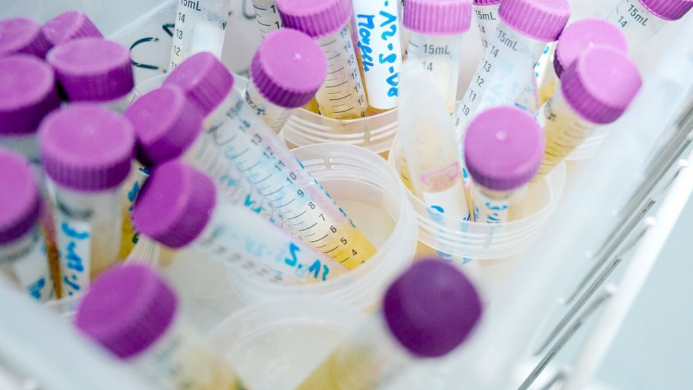 MnHexP ist ein Abbauprodukt des Weichmachers Di-n-hexylphthalat (DnHexP), der als fortpflanzungsschädigend gilt. (Symbolbild) Foto: Bernd Thissen