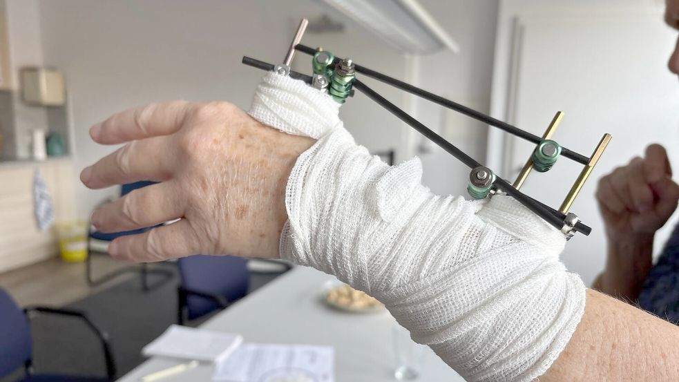 Das Handgelenk einer Emderin ist zertrümmert. Die Verletzung hat sie sich bei einem Sturz vor einem Gebäude in Uphusen zugezogen, sagt sie. Der Gehweg sei nicht geräumt gewesen. Foto: Mona Hanssen