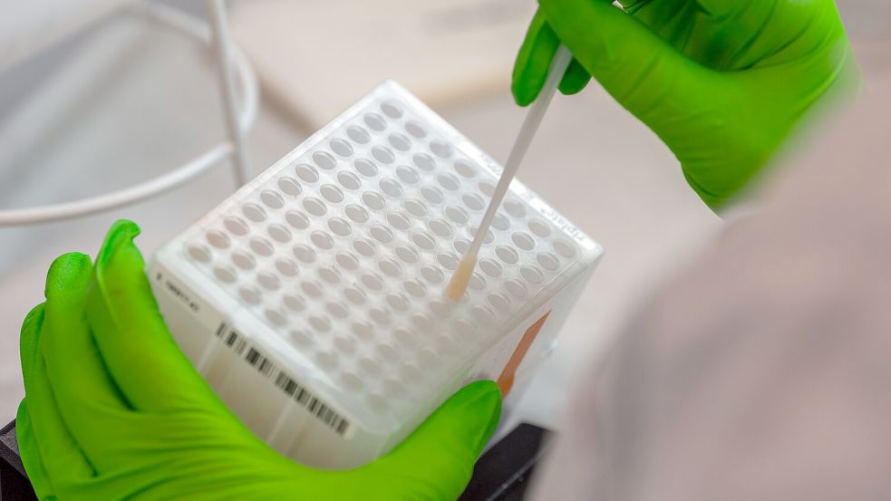 Eine Mitarbeiterin der DKMS sortiert medizinische Wattestäbchen mit Zellen der Wangenschleimhaut für den Typisierungsprozess. Foto: Robert Michael/dpa