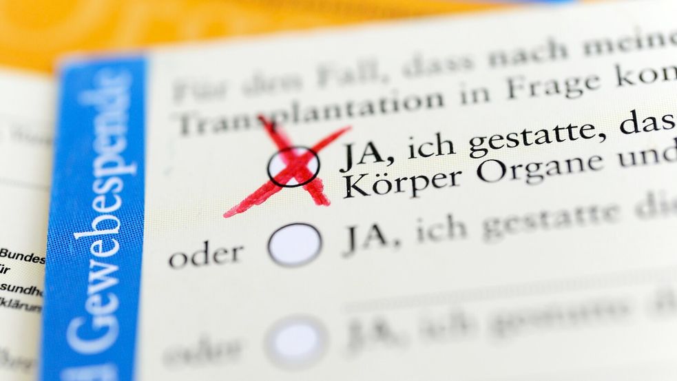 In Deutschland müssen spätere Spender zu Lebzeiten oder stellvertretend die Angehörigen einer Organentnahme explizit zustimmen. (Symbolbild) Foto: Marie Reichenbach/dpa