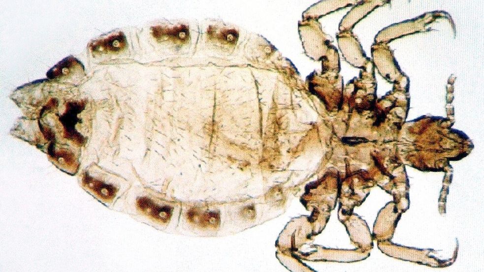Das Bild zeigt eine stark vergrößerte Aufnahme einer Kopflaus am Computer. Foto: DPA