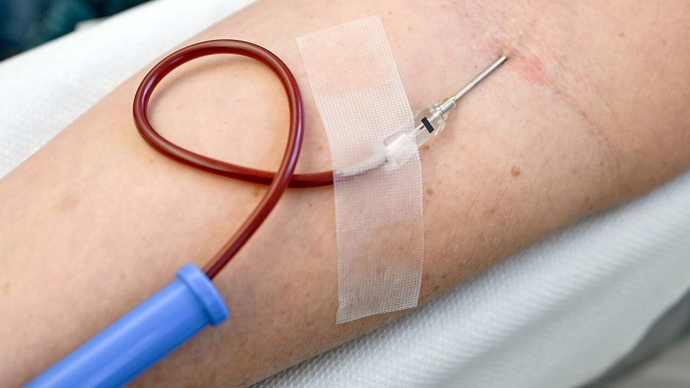 Nur gesunde Menschen sollten Blut spenden. (Symbolbild) Foto: Jens Kalaene/dpa