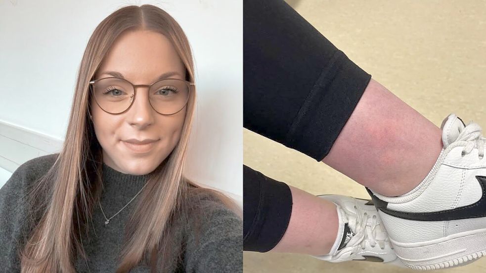Nach ihrem Zeitungsbericht über den Verdacht auf einen Impfschaden bekommt Mayline Spanier aus Rhauderfehn zahlreiche Reaktionen – darunter Hilfsangebote, ähnliche Schilderungen und auch verletzende Kommentare. Foto: privat